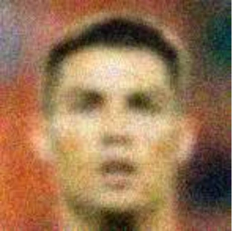 A severely degraded photograph of a face.